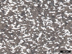 Gefuegebeurteilung_Titan_Titanlegierung_alpha_beta